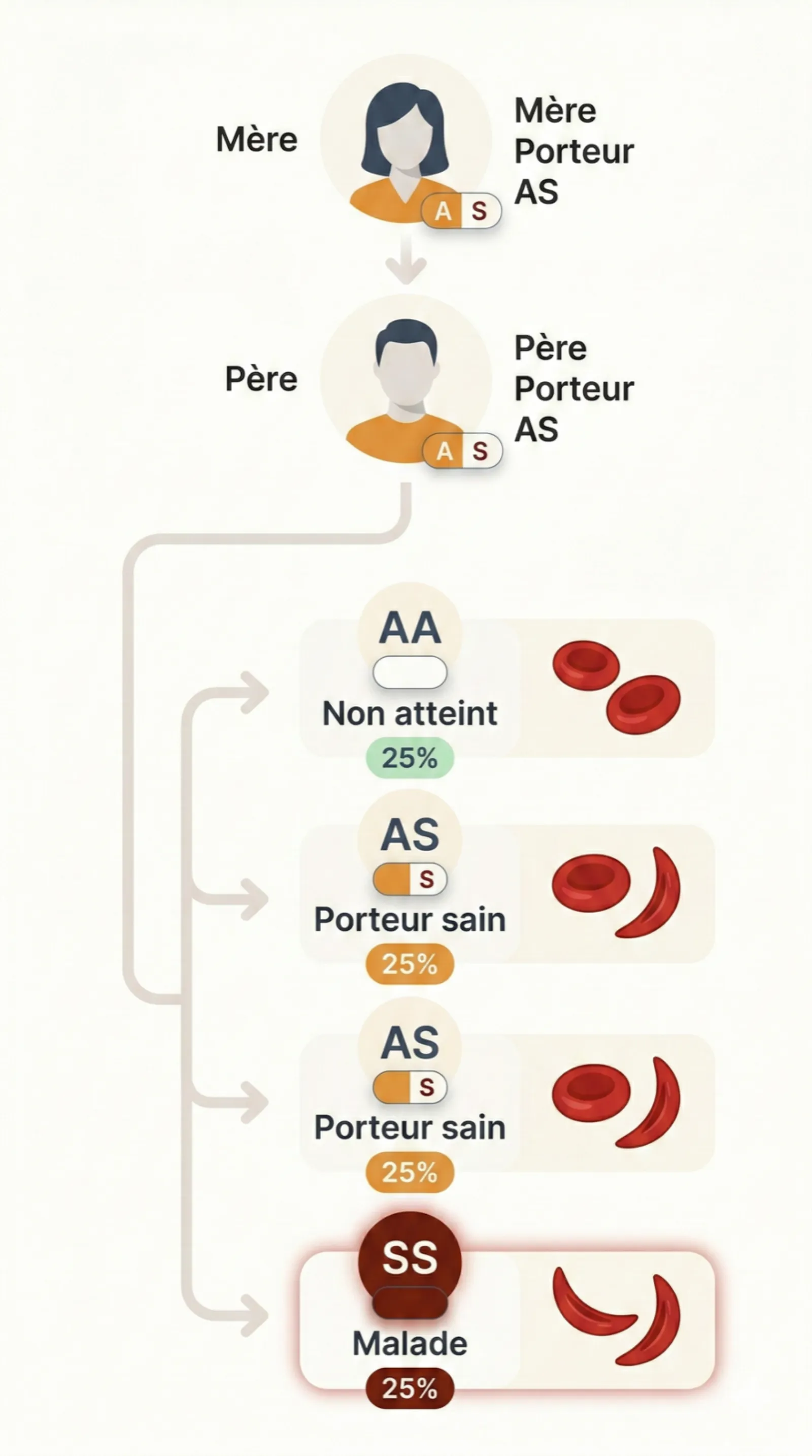 Schéma de transmission génétique de la drépanocytose : deux parents porteurs AS peuvent avoir un enfant non atteint (AA, 25%), deux enfants porteurs sains (AS, 25% chacun) ou un enfant malade (SS, 25%)